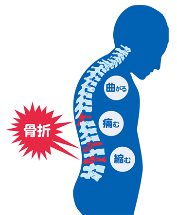 その症状、骨粗しょう症かも…